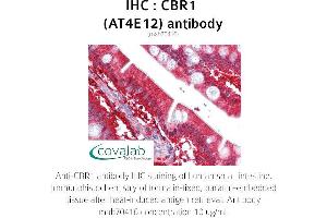 Image no. 1 for anti-Carbonyl Reductase 1 (CBR1) antibody (ABIN1724380) (CBR1 antibody)