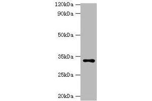 Western blot All lanes: HSD11B1 antibody at 2 μg/mL + Hela whole cell lysate Secondary Goat polyclonal to rabbit IgG at 1/10000 dilution Predicted band size: 33 kDa Observed band size: 33 kDa (HSD11B1 antibody  (AA 25-292))