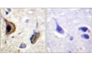 Immunohistochemistry analysis of paraffin-embedded human brain, using Kir5. (KIR5.1 antibody  (pSer417))