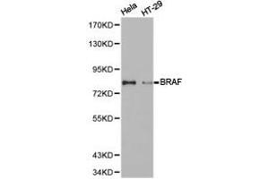 Western Blotting (WB) image for anti-B-Raf proto-oncogene, serine/threonine kinase (BRAF) antibody (ABIN1871340) (BRAF antibody)