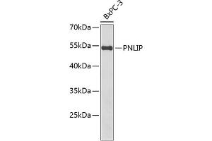 Western blot analysis of extracts of BxPC-3 cells, using PNLIP antibody  at 1:1000 dilution. (PNLIP antibody  (AA 166-465))