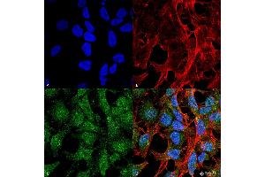 Immunocytochemistry/Immunofluorescence analysis using Rabbit Anti-UVRAG Polyclonal Antibody . (UVRAG antibody)