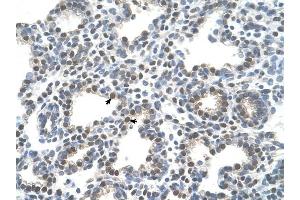 SLC10A5 antibody was used for immunohistochemistry at a concentration of 4-8 ug/ml to stain Alveolar cells (arrows) in Human Lung.
