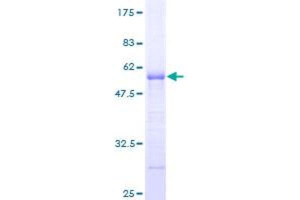 ARHGDIG Protein (AA 1-225) (GST tag)