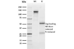 SDS-PAGE Analysis Purified n-Myc Mouse Monoclonal Antibody (NMYC-1). (MYCN antibody)
