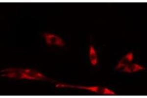ABIN6275011 staining LOVO cells by IF/ICC. (CHPF antibody  (C-Term))