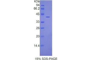 SDS-PAGE analysis of Mouse Angiotensin III Protein. (Angiotensin III Protein (AGT3))