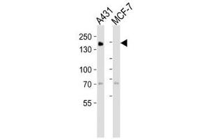 Western blot analysis of lysate from A431, MCF-7 cell line (left to right) using EGF Receptor antibody at 1:1000 for each lane. (EGFR antibody  (AA 1163-1191))