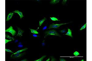 Immunofluorescence of purified MaxPab antibody to FOLR1 on HeLa cell. (FOLR1 antibody  (AA 1-257))