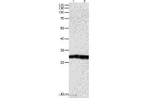 Western blot analysis of Jurkat cell and human fetal kidney tissue, using DUSP6 Polyclonal Antibody at dilution of 1:450