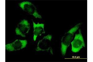 Immunofluorescence of purified MaxPab antibody to USP10 on HeLa cell. (USP10 antibody  (AA 1-798))