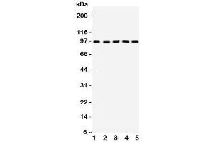 Western blot testing of TRKC antibody on Lane 1: rat brain;  2: mouse brain;  3: human U87;  4: (h) SHG-44;  5: (m) Neuro-2a cell lysate. (NTRK3 antibody  (AA 167-182))