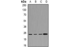 Western blot analysis of CLIC1 expression in Hela (A), HepG2 (B), mouse lung (C), rat kidney (D) whole cell lysates. (CLIC1 antibody)