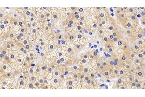 Immunohistochemistry (IHC) image for anti-BCL2-Associated Agonist of Cell Death (BAD) (AA 1-168) antibody (ABIN7443224)