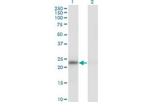 Western Blot analysis of MAD2L1 expression in transfected 293T cell line by MAD2L1 monoclonal antibody (M01), clone 2E2-1D6. (MAD2L1 antibody  (AA 1-205))