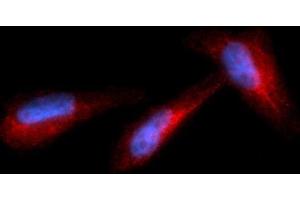 Immunofluorescence (IF) image for anti-Granzyme B (GZMB) (AA 21-247) antibody (PE) (ABIN5564764)