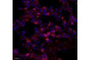 Immunofluorescence of paraffin embedded mouse lung using ARHGAP18 (ABIN7075417) at dilution of 1: 700 (450x lens) (ARHGAP18 antibody)