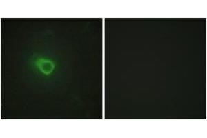 Immunofluorescence analysis of HeLa cells, using JAK1 Antibody.