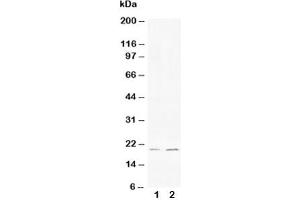 Western blot testing of Bcl-XS antibody and Lane 1:  HeLa (Bcl-X/s (AA 120-130) antibody)