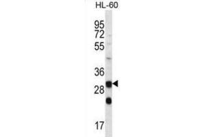 Western Blotting (WB) image for anti-Carbonic Anhydrase VI (CA6) antibody (ABIN2996883) (CA6 antibody)