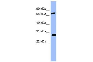 COMT antibody used at 1 ug/ml to detect target protein. (COMT antibody  (Middle Region))