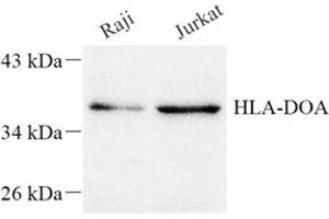 Western blot analysis of HLADOA (ABIN7074244) at dilution of 1: 1500 (HLA-DOA antibody)