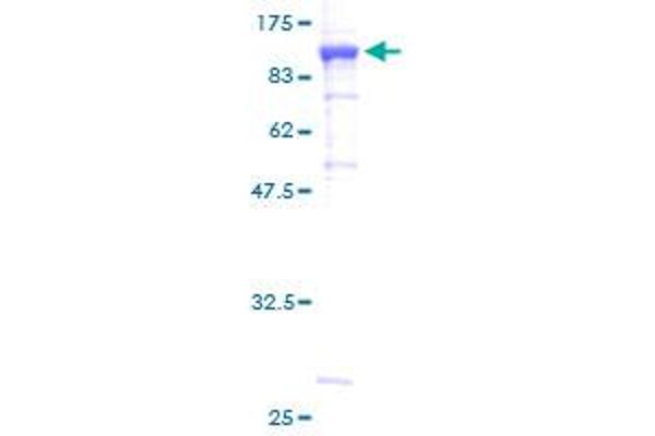 MUT Protein (AA 1-750) (GST tag)