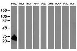 Image no. 1 for anti-Sulfotransferase Family, Cytosolic, 1A, Phenol-Preferring, Member 1 (SULT1A1) antibody (ABIN1501227)