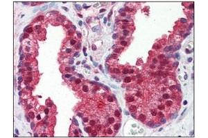 Immunohistochemistry (IHC) image for anti-Folate Hydrolase (Prostate-Specific Membrane Antigen) 1 (FOLH1) (AA 117-351) antibody (ABIN317554)