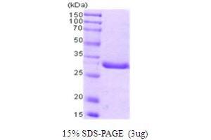 SDS-PAGE (SDS) image for Proliferating Cell Nuclear Antigen (PCNA) (AA 1-261) protein (ABIN667068) (PCNA Protein (AA 1-261))