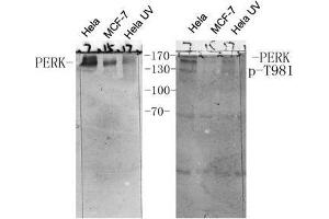 Western Blot (WB) analysis of specific cells using antibody diluted at 1:1000. (PERK antibody  (pThr981))