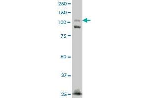 FNDC3A monoclonal antibody (M01), clone 2H4 Western Blot analysis of FNDC3A expression in A-431 .