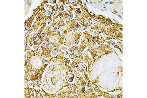 Immunohistochemistry (Paraffin-embedded Sections) (IHC (p)) image for anti-Adrenergic, Beta, Receptor Kinase 1 (ADRBK1) (AA 440-689) antibody (ABIN3022346)