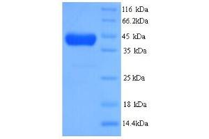 SDS-PAGE (SDS) image for 5-Methyltetrahydrofolate-Homocysteine Methyltransferase (MTR) (AA 923-1265) protein (His tag) (ABIN5714456)
