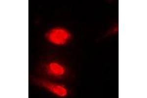 Immunofluorescent analysis of Annexin A11 staining in Jurkat cells. (Annexin A11 antibody)