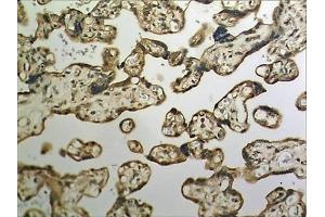 Immunohistochemistry (IHC) image for anti-Ephrin Type A Receptor 1 (EPHA1) (AA 24-547) antibody (ABIN1983165)