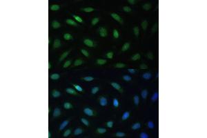 Immunofluorescence analysis of U-2 OS cells using LBR Polyclonal Antibody (ABIN6128194, ABIN6143105, ABIN6143106 and ABIN6221130) at dilution of 1:100 (40x lens). (Lamin B Receptor antibody  (AA 1-211))
