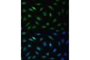 Immunofluorescence analysis of U-2 OS cells using LBR Polyclonal Antibody (ABIN6128194, ABIN6143105, ABIN6143106 and ABIN6221130) at dilution of 1:100 (40x lens). (Lamin B Receptor antibody  (AA 1-211))