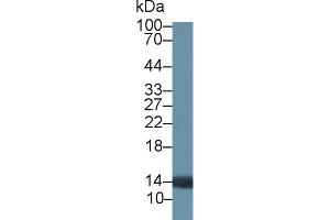 Detection of PTK6 in Rat Prostate lysate using Polyclonal Antibody to Protein Tyrosine Kinase 6 (PTK6) (PTK6 antibody  (AA 191-445))