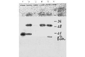 Western Blotting (WB) image for anti-Human Papilloma Virus 18 E7 (HPV-18 E7) (AA 1-35), (N-Term) antibody (ABIN781779) (HPV18 E7 antibody  (N-Term))