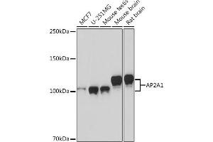 Western blot analysis of extracts of various cell lines, using  Rabbit mAb (ABIN1681069, ABIN3018897, ABIN3018898 and ABIN7101684) at 1:1000 dilution.