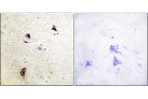 Immunohistochemistry analysis of paraffin-embedded human brain, using Rabphilin 3A (Phospho-Ser237) Antibody. (RPH3A antibody  (pSer237))