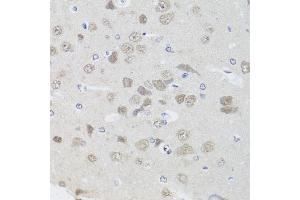 Immunohistochemistry of paraffin-embedded rat brain using PPP1CC antibody (ABIN5972199) at dilution of 1/100 (40x lens). (PPP1CC antibody)