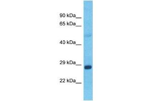 Host:  Rabbit  Target Name:  GRHL1  Sample Type:  Lung tumor lysates  Antibody Dilution:  1. (GRHL1 antibody  (C-Term))
