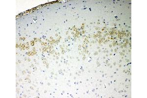 Anti-VE Cadherin antibody, IHC(P) IHC(P): Rat Brain Tissue (Cadherin 5 antibody  (C-Term))