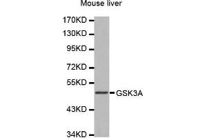 Western Blotting (WB) image for anti-Glycogen Synthase Kinase 3 alpha (GSK3a) (AA 409-483) antibody (ABIN6213918) (GSK3 alpha antibody  (AA 409-483))