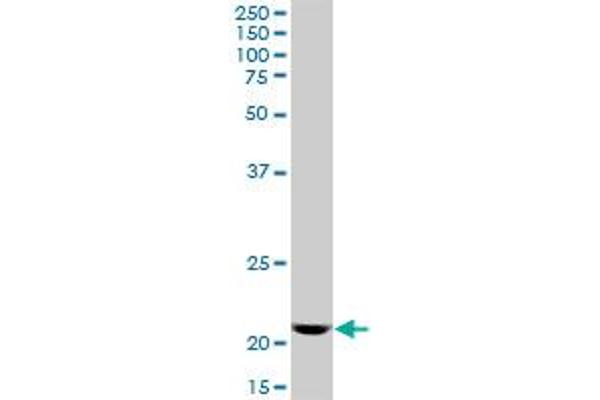 DR1 antibody  (AA 1-176)