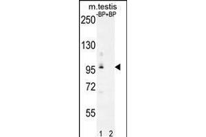 Western blot analysis of PDPR Antibody Pab pre-incubated without(lane 1) and with(lane 2) blocking peptide in mouse testis tissue lysate (PDP antibody  (C-Term))
