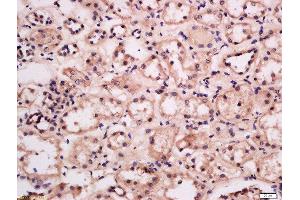 Formalin-fixed and paraffin embedded human kidney labeled with Anti-GRB10/14 Polyclonal Antibody, Unconjugated  at 1:300 followed by conjugation to the secondary antibody and DAB staining. (GRB10/14 (AA 501-594) antibody)