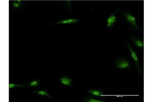 Immunofluorescence of monoclonal antibody to HEXIM1 on HeLa cell. (HEXIM1 antibody  (AA 1-359))